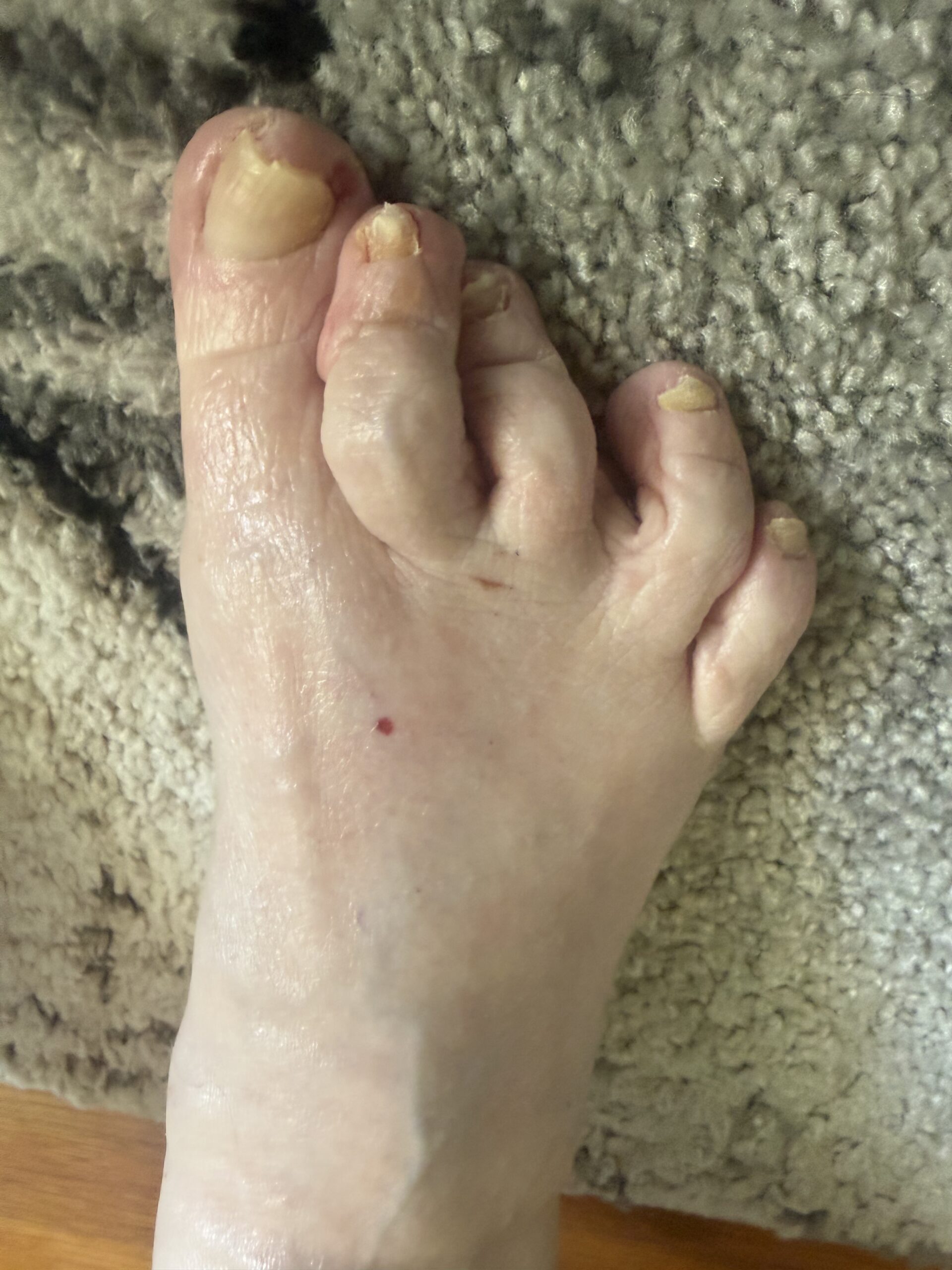After image